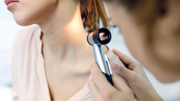 Cilt kanserinde kişiye özel aşı