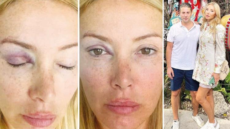 Yeşim Erçetin boşanıyor! ‘Uğursuz geldin’ dedi şiddet uyguladı