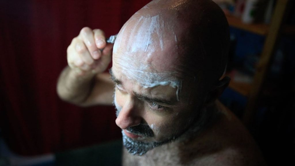 Bilim insanları duyurdu: Alkol erkeklerde kelleşmeye neden oluyor