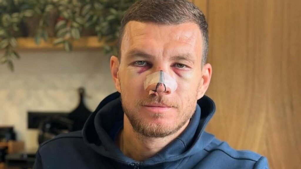 Edin Dzeko’dan Galatasaray derbisi öncesi özel talep