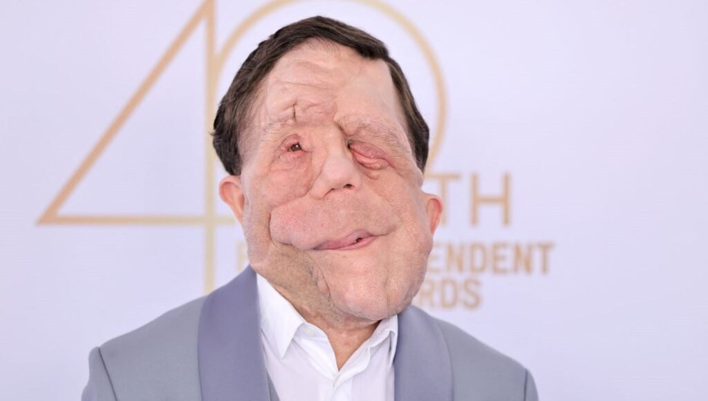 Fil Adam yeniden çekiliyor: Başrol oyuncusu belli oldu