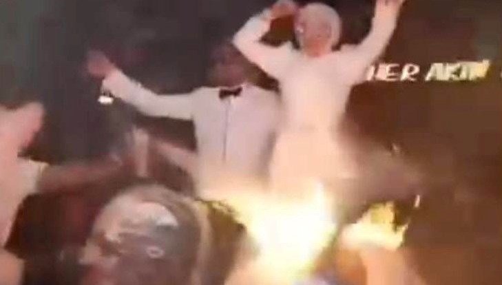 Düğünde korku dolu anlar: Saçları tutuştu