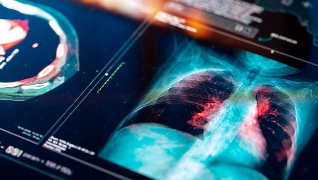 2007’den bu yana ilk: En öldürücü tür, 1 kişi hayatını kaybetti