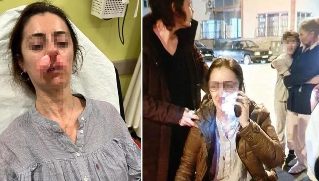 Otomobil kapısı silah sayıldı! Eşinin sevgilisi sandı, arabanın kapısıyla saldırdı