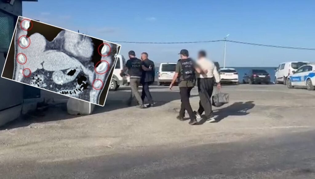 Yolcu otobüsündeki iki şüphelinin midesinden 136 kapsül uyuşturucu çıktı