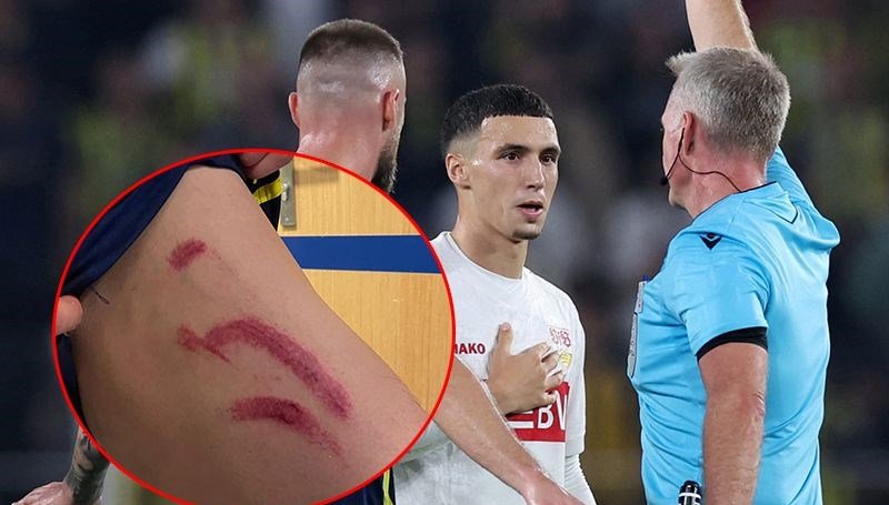 Fenerbahçe-Stuttgart maçına damga vuran olay: Devre arasında ortaya çıkan görüntü korkuttu!