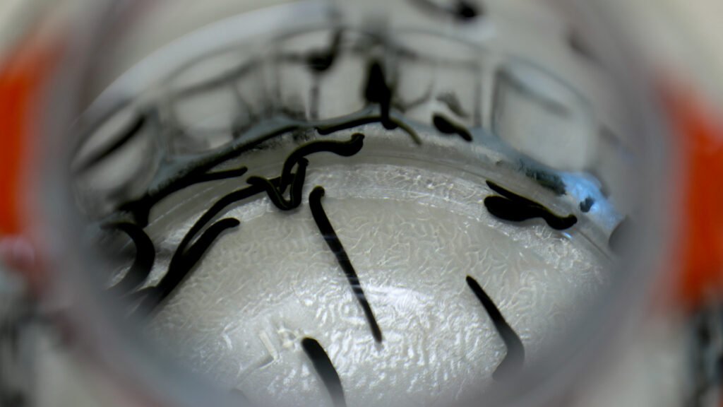 Hacamat, sülük, akupunktur… Bakanlık bünyesinde enstitü kuruldu, geleneksel tıp geliştirilecek