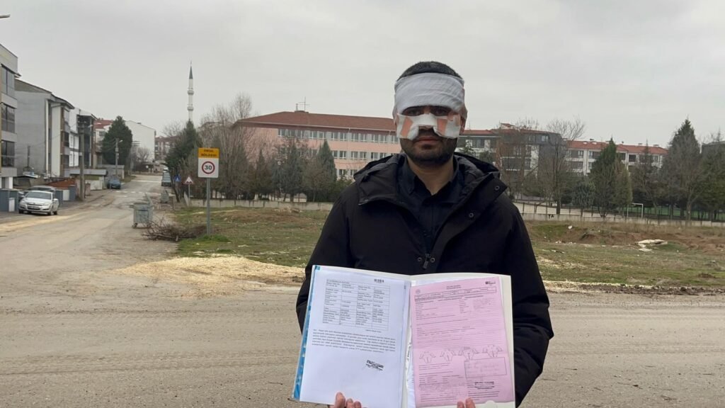 Öğretmen öğretmeni yaktı. Yüzüne sıcak çay fırlattı!