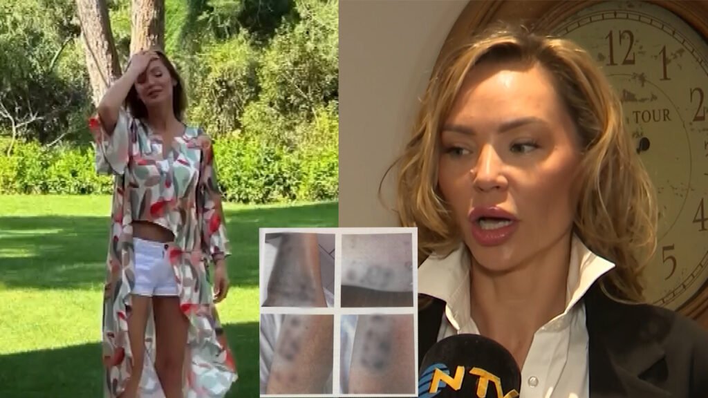 Şişli’de estetik yaptırmak isteyen mankenin vücudu yandı. Dizilerde oynuyordu, işinden oldu